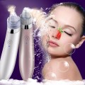 Máy hút mụn mũi có pin sạc 4 đầu hút chuyên dụng J160