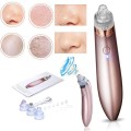 Máy hút mụn mũi có pin sạc 4 đầu hút chuyên dụng J160