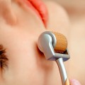 Cây lăn kim chuyên dụng hỗ trợ tái tạo da, cải thiện sẹo J145