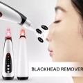 Máy hút mụn đầu đen cao cấp, đem lại làn da sáng bóng BA1122