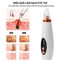 Máy hút mụn làm sạch mụn cám, bã nhờn sử dụng pin tiện lợi BA1123