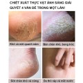 Kem điều trị nứt gót chân, làm mềm tế bào da chết BA1222