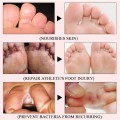 Kem điều trị nứt gót chân, làm mềm tế bào da chết BA1222