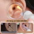 Bộ lấy ráy tai chuyên nghiệp có đèn led sử dụng an toàn BA1285